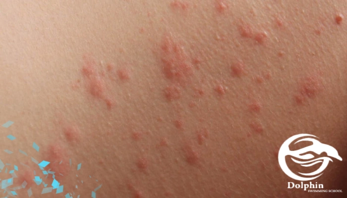 مقایسه تاثیر بر سلامت پوست